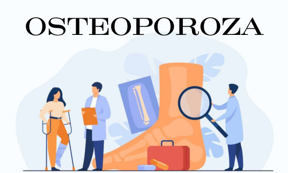 Osteoporoza – przyczyny, objawy, profilaktyka, leczenie